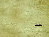 Cellule corticali in visione superficiale